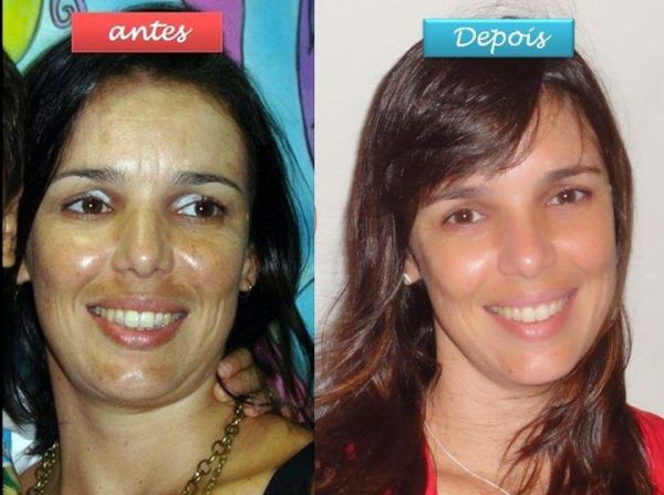 kit limpeza de pele